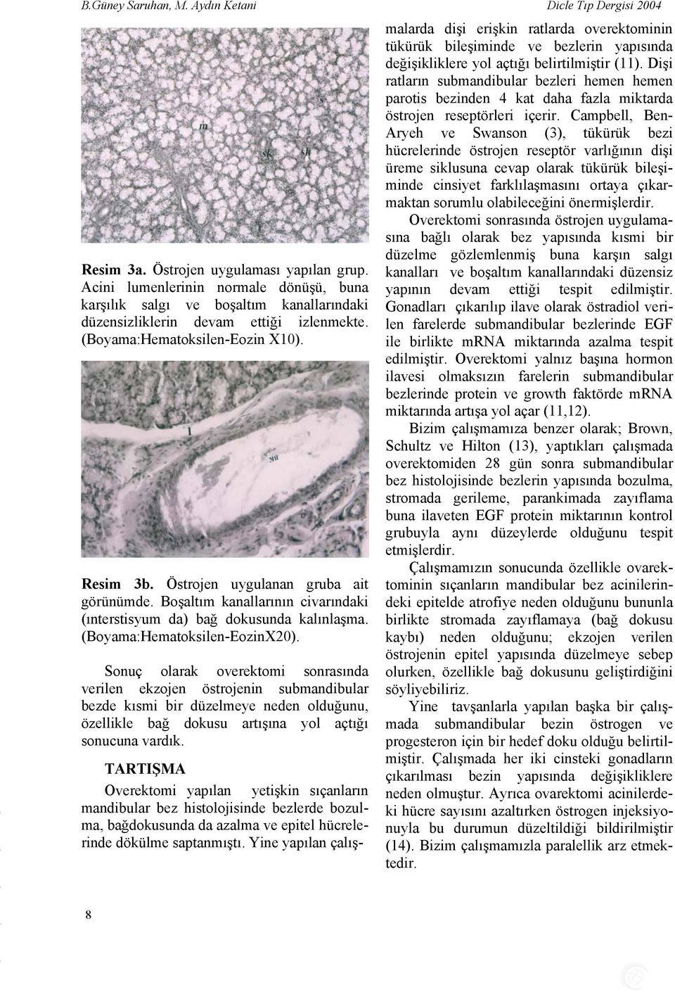 Östrojen uygulanan gruba ait görünümde. Boşaltım kanallarının civarındaki (ınterstisyum da) bağ dokusunda kalınlaşma. (Boyama:Hematoksilen-EozinX20).