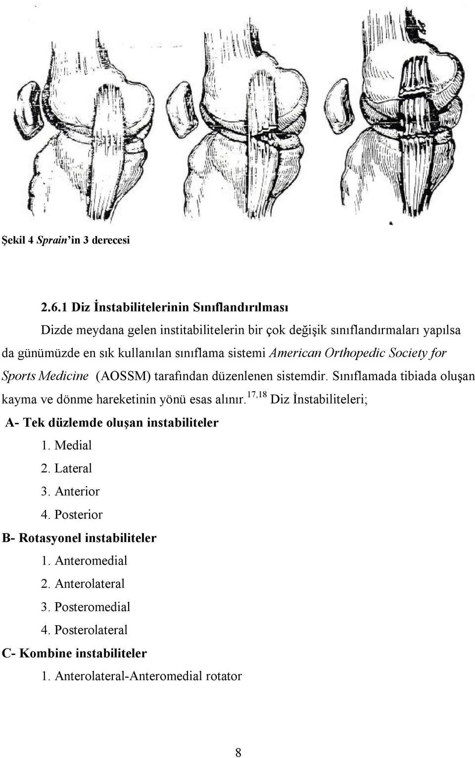 sınıflama sistemi American Orthopedic Society for Sports Medicine (AOSSM) tarafından düzenlenen sistemdir.