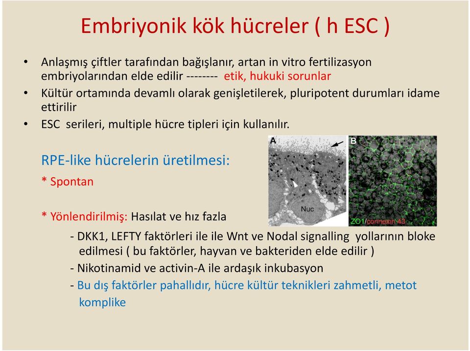 RPE like hücrelerin üretilmesi: * Spontan * Yönlendirilmiş: Hasılat ve hız fazla DKK1, LEFTY faktörleri ile ile Wnt ve Nodal signalling yollarının bloke