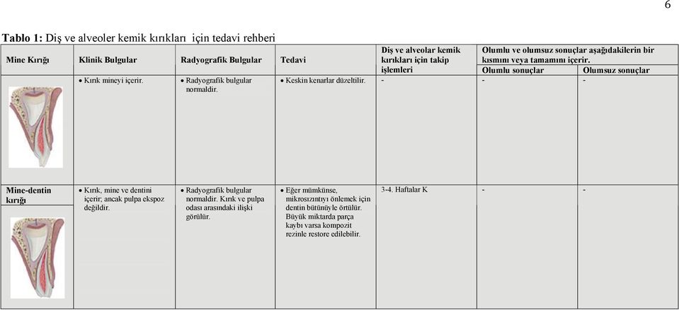 Keskin kenarlar düzeltilir. - - - Mine-dentin kırığı Kırık, mine ve dentini içerir; ancak pulpa ekspoz değildir. Radyografik bulgular normaldir.