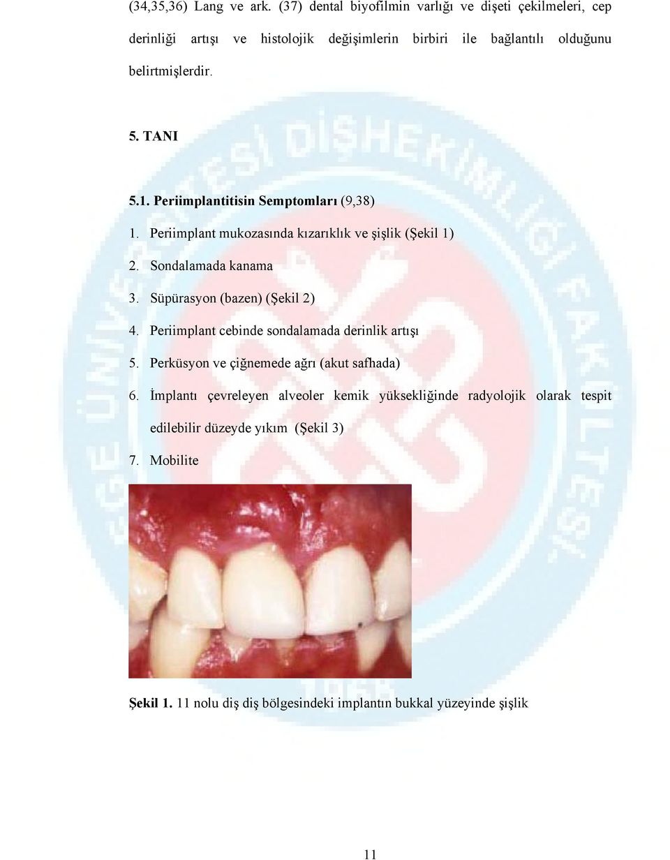 TANI 5.1. Periimplantitisin Semptomları (9,38) 1. Periimplant mukozasında kızarıklık ve şişlik (Şekil 1) 2. Sondalamada kanama 3.