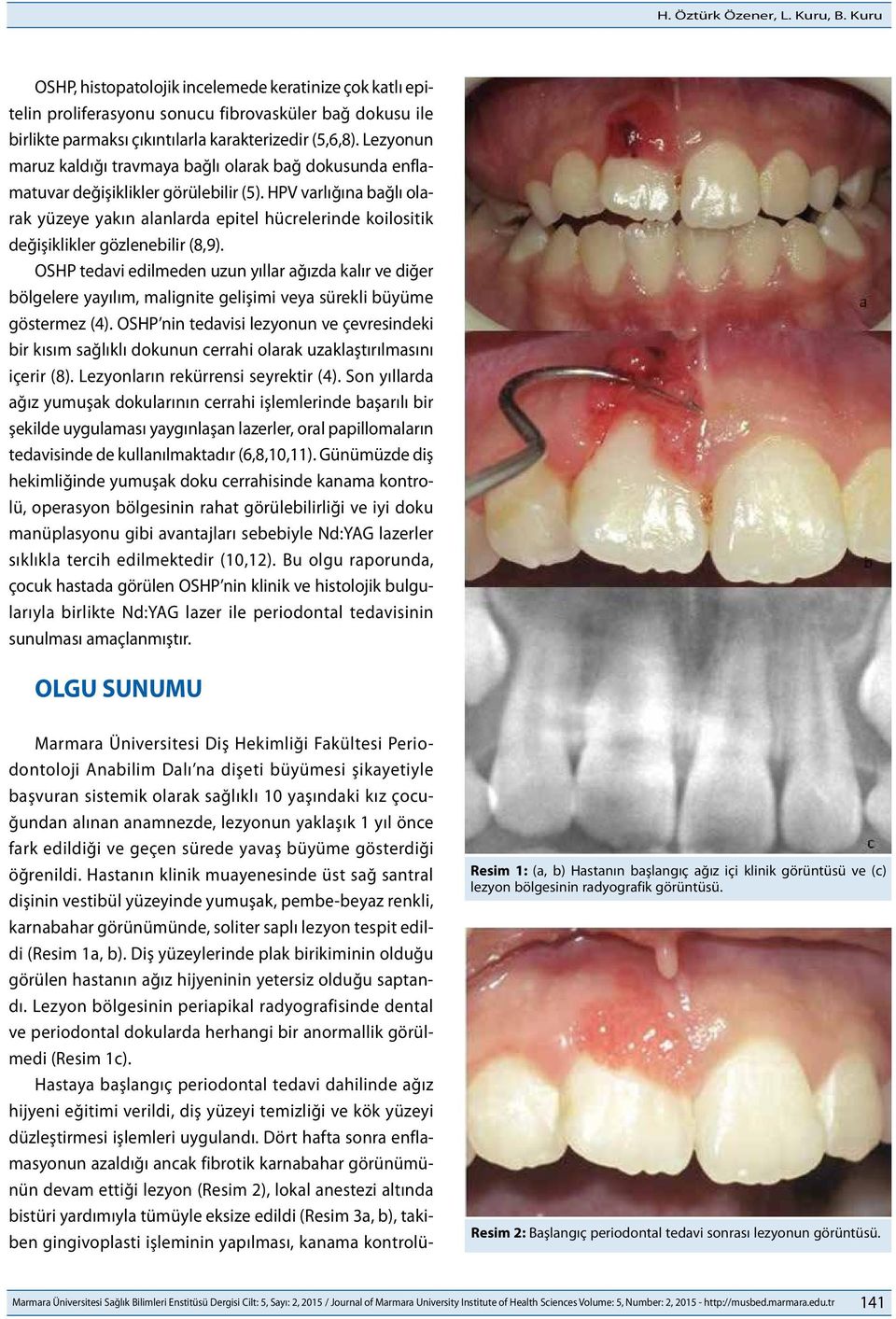 Lezyonun maruz kaldığı travmaya bağlı olarak bağ dokusunda enflamatuvar değişiklikler görülebilir (5).