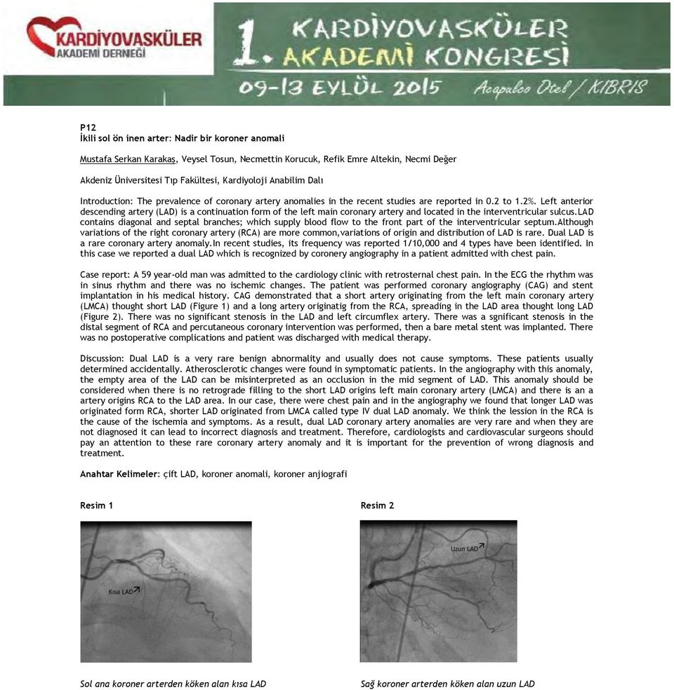 Left anterior descending artery (LAD) is a continuation form of the left main coronary artery and located in the interventricular sulcus.