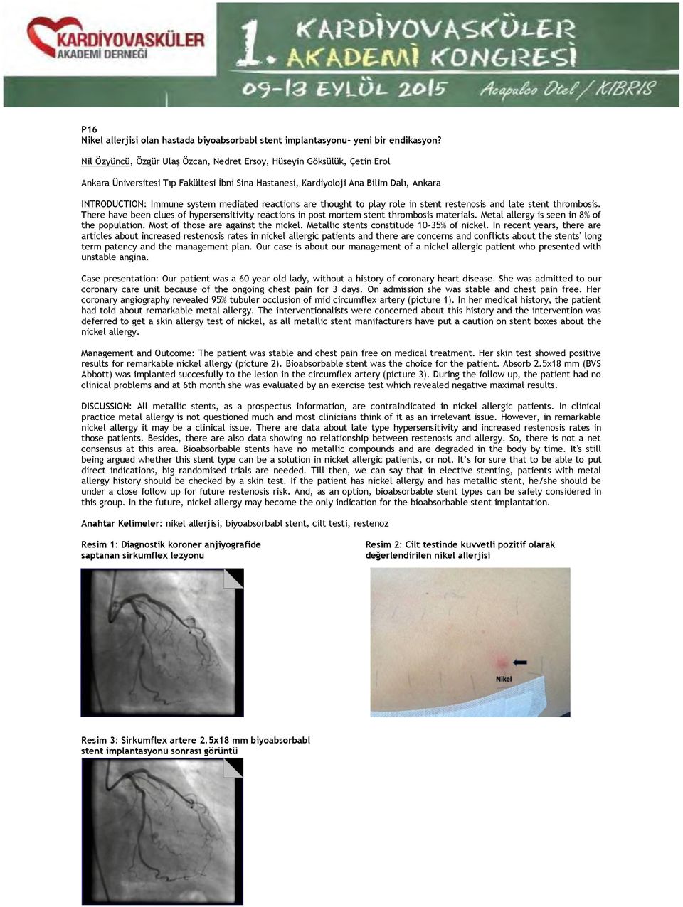 mediated reactions are thought to play role in stent restenosis and late stent thrombosis. There have been clues of hypersensitivity reactions in post mortem stent thrombosis materials.