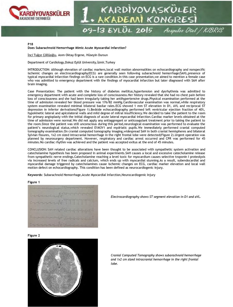 abnormalities on echocardiography and nonspecific ischemic changes on electrocardiography(ecg) are generally seen following subarachnoid hemorrhage(sah),presence of typical myocardial infarction