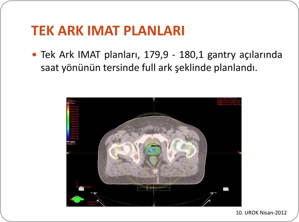 gantry açılarında saat yönünün