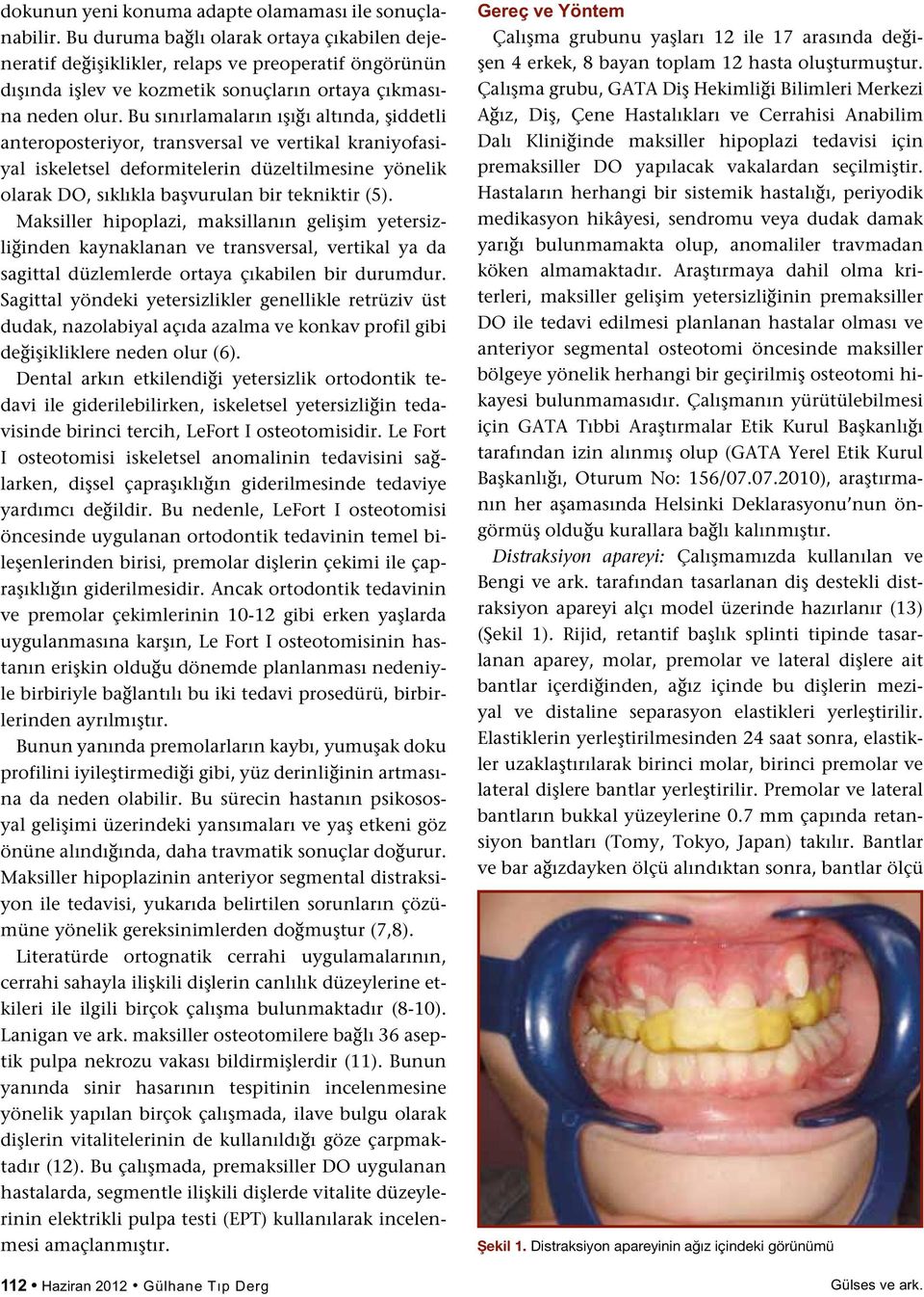 Bu sınırlamaların ışığı altında, şiddetli anteroposteriyor, transversal ve vertikal kraniyofasiyal iskeletsel deformitelerin düzeltilmesine yönelik olarak DO, sıklıkla başvurulan bir tekniktir (5).