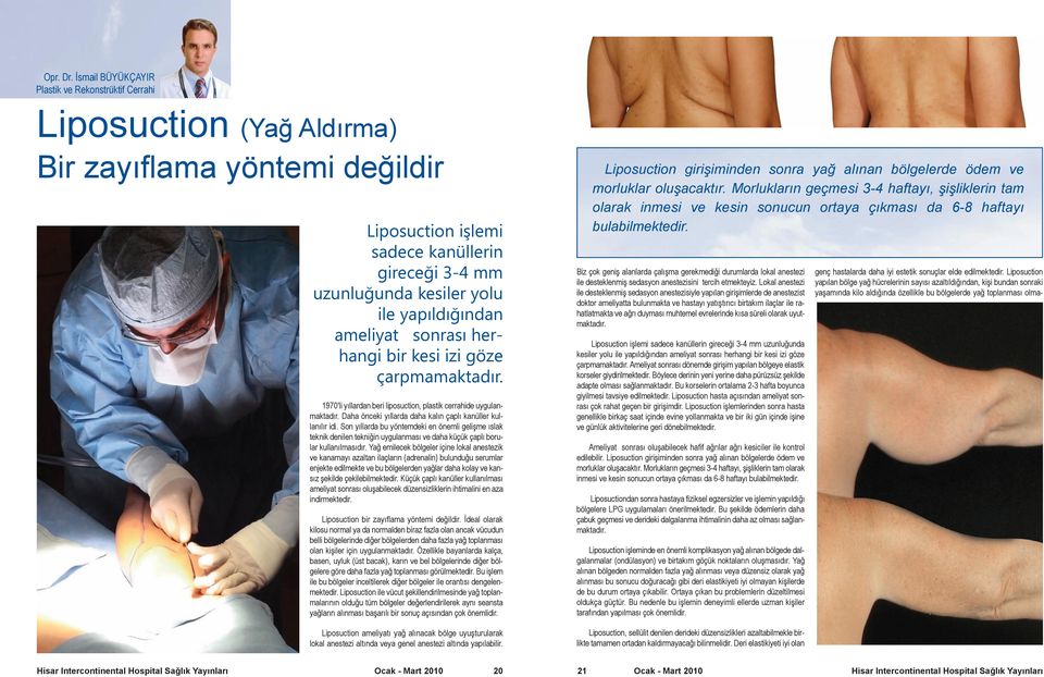 yapıldığından ameliyat sonrası herhangi bir kesi izi göze çarpmamaktadır. 1970'li yıllardan beri liposuction, plastik cerrahide uygulanmaktadır.