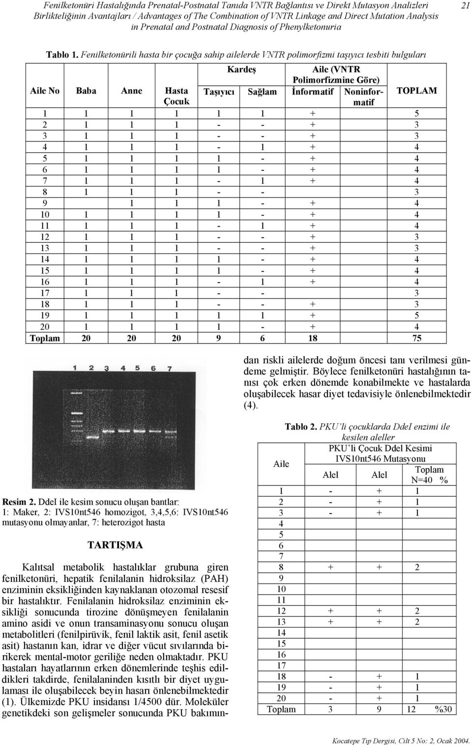Fenilketonürili hasta bir çocuğa sahip ailelerde VNTR polimorfizmi taşıyıcı tesbiti bulguları Kardeş Aile (VNTR Polimorfizmine Göre) Aile No Baba Anne Hasta Taşıyıcı Sağlam İnformatif Noninformatif
