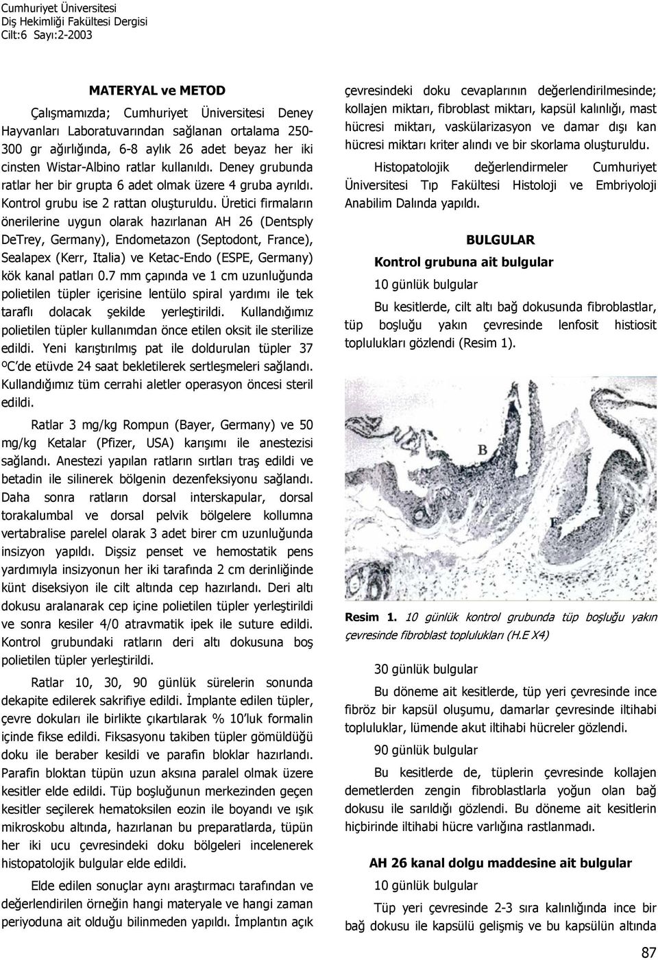 Üretici firmaların önerilerine uygun olarak hazırlanan AH 26 (Dentsply DeTrey, Germany), Endometazon (Septodont, France), Sealapex (Kerr, Italia) ve Ketac-Endo (ESPE, Germany) kök kanal patları 0.