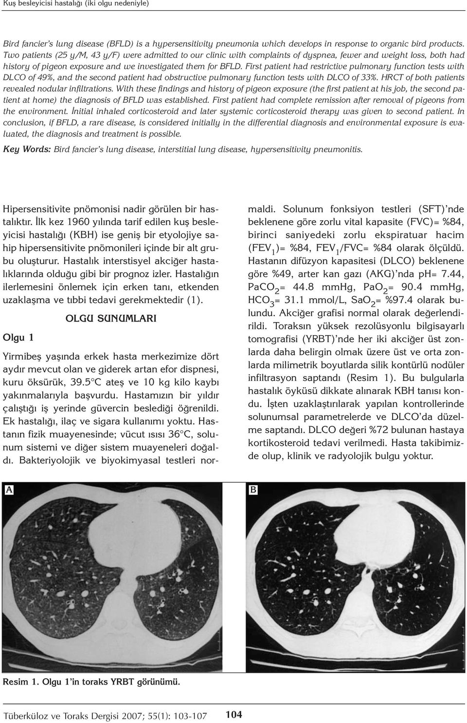 First patient had restrictive pulmonary function tests with DLCO of 49%, and the second patient had obstructive pulmonary function tests with DLCO of 33%.