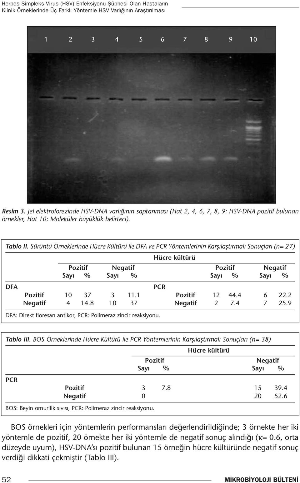 Sürüntü Örneklerinde Hücre Kültürü ile DFA ve PCR Yöntemlerinin Karşılaştırmalı Sonuçları (n= 27) Hücre kültürü Pozitif Negatif Pozitif Negatif Sayı % Sayı % Sayı % Sayı % DFA PCR Pozitif 10 37 3 11.