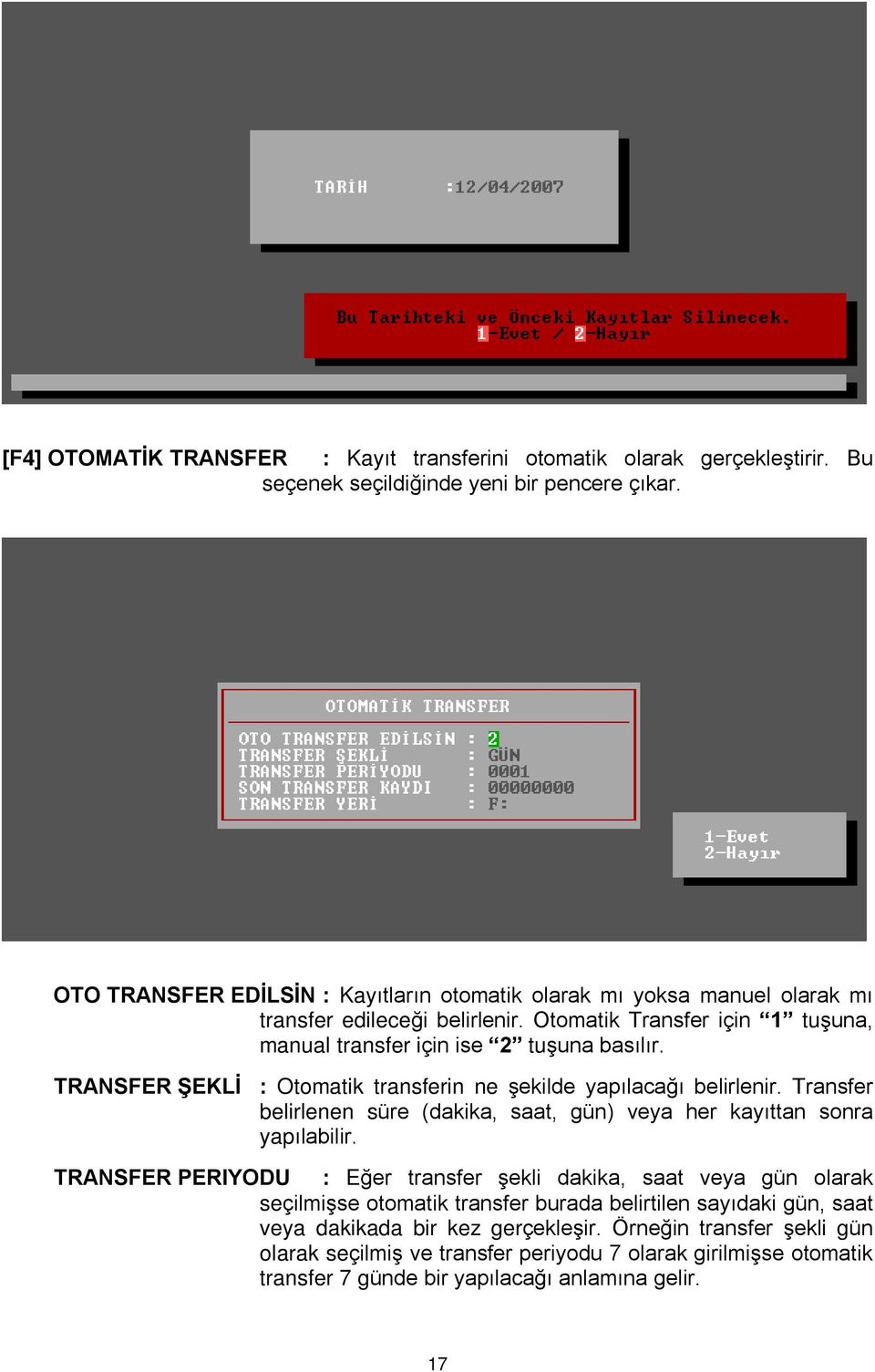 TRANSFER ªEKLÝ : Otomatik transferin ne ºekilde yapýlacaðý belirlenir. Transfer belirlenen süre (dakika, saat, gün) veya her kayýttan sonra yapýlabilir.