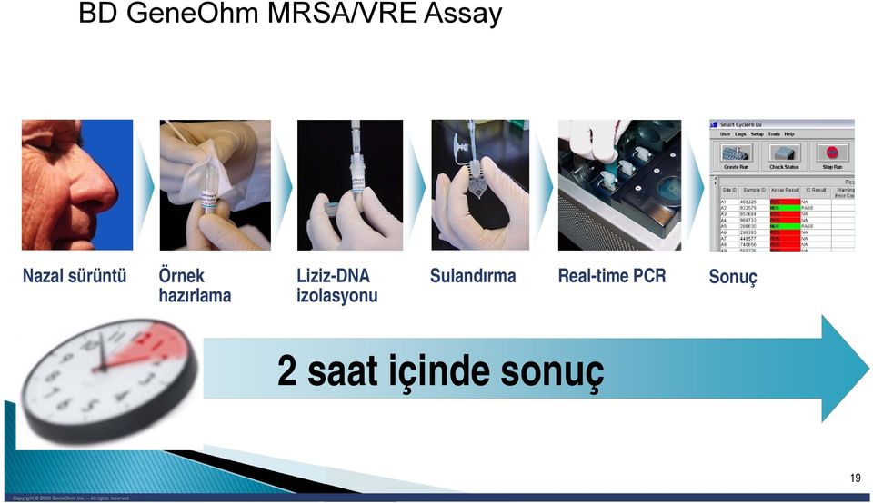 Sulandırma Real-time PCR Sonuç 2 saat içinde