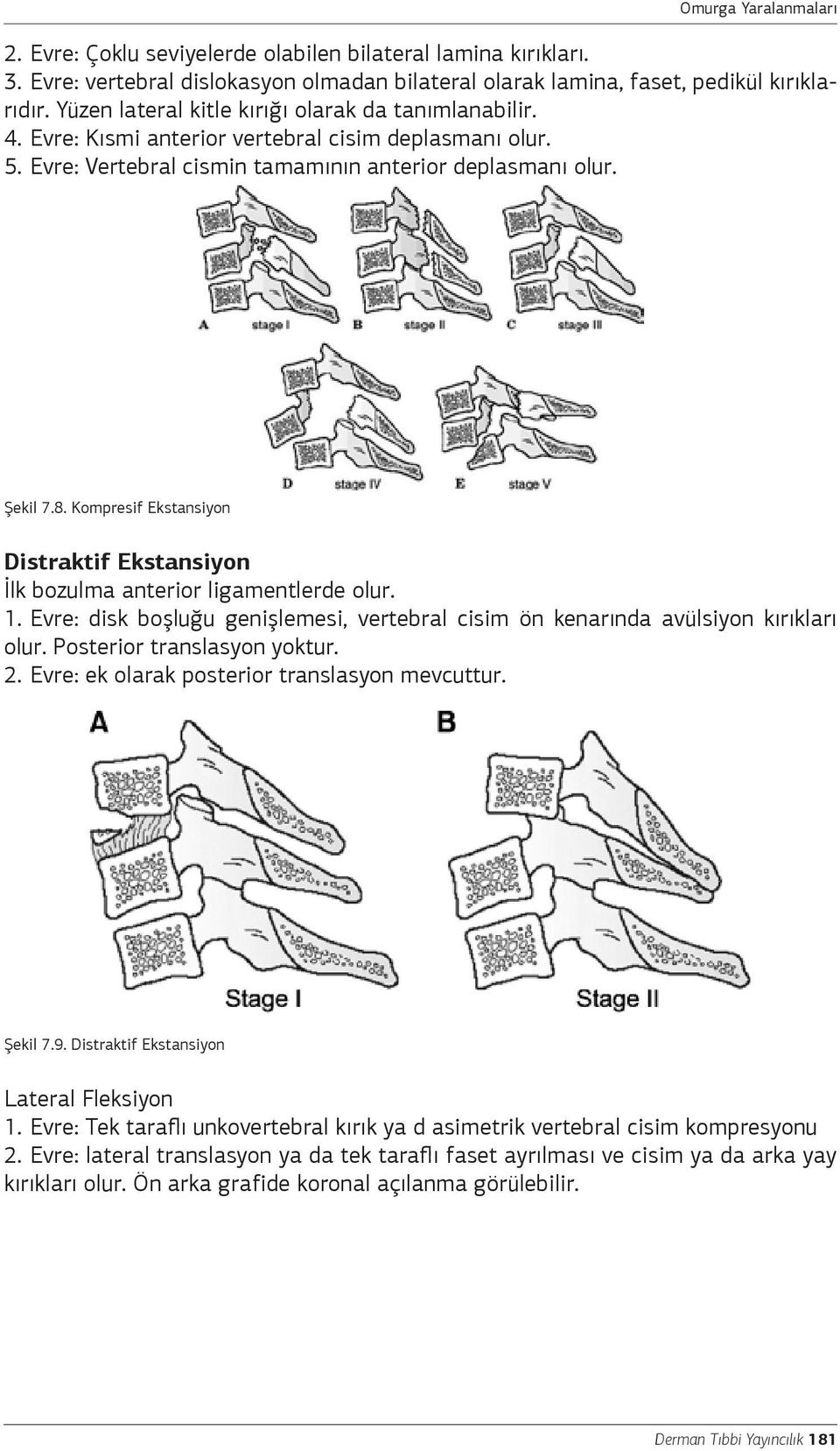 Kompresif Ekstansiyon Distraktif Ekstansiyon İlk bozulma anterior ligamentlerde olur. 1. Evre: disk boşluğu genişlemesi, vertebral cisim ön kenarında avülsiyon kırıkları olur.