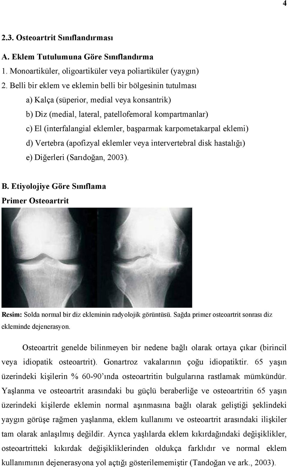 karpometakarpal eklemi) d) Vertebra (apofizyal eklemler veya intervertebral disk hastalığı) e) Diğerleri (Sarıdoğan, 2003). B.