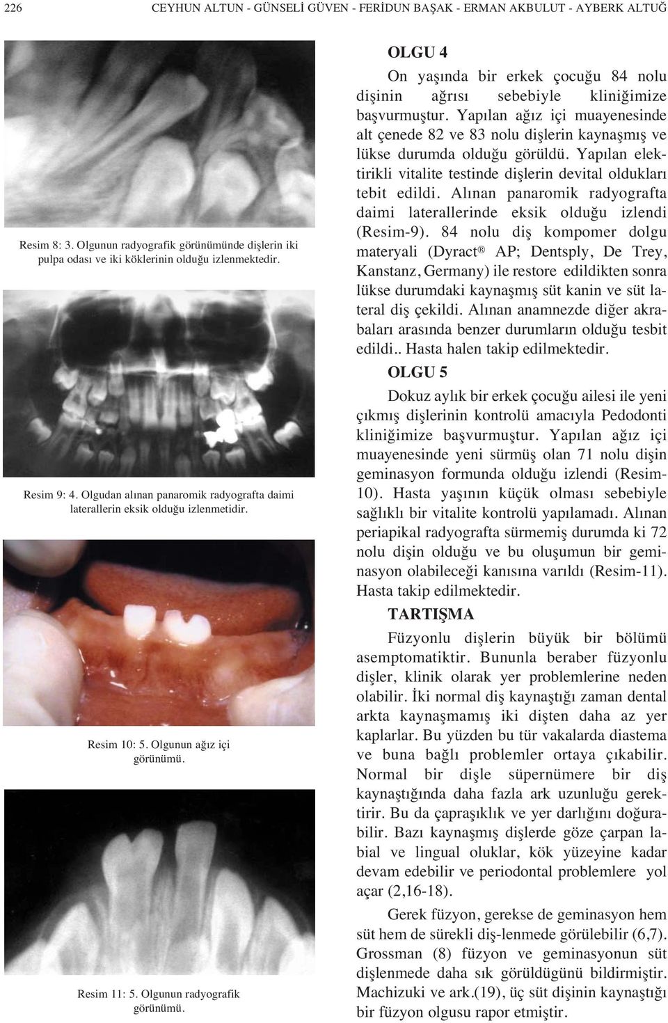 Olgunun radyografik OLGU 4 On yaş nda bir erkek çocuğu 84 nolu dişinin ağr s sebebiyle kliniğimize başvurmuştur.