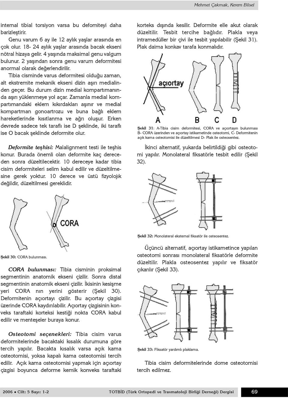 Tibia cisminde varus deformitesi olduðu zaman, alt ekstremite mekanik ekseni dizin aþýrý medialinden geçer. Bu durum dizin medial kompartýmanýnda aþýrý yüklenmeye yol açar.