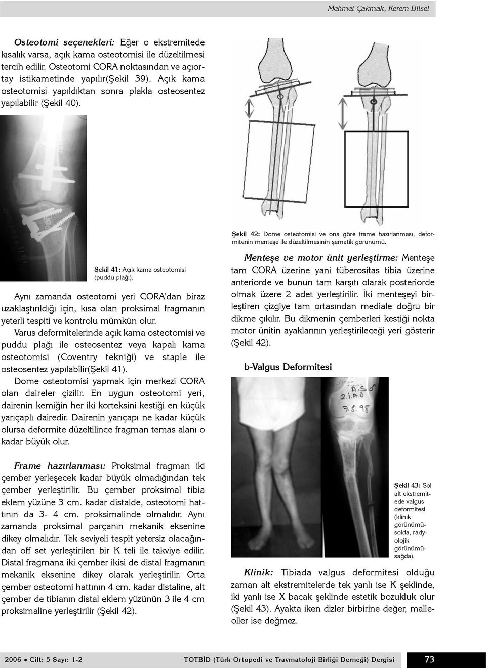 Þekil 42: Dome osteotomisi ve ona göre frame hazýrlanmasý, deformitenin menteþe ile düzeltilmesinin þematik görünümü. Þekil 41: Açýk kama osteotomisi (puddu plaðý).