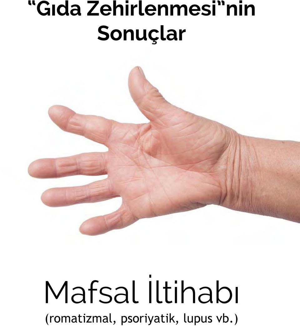 İltihabı