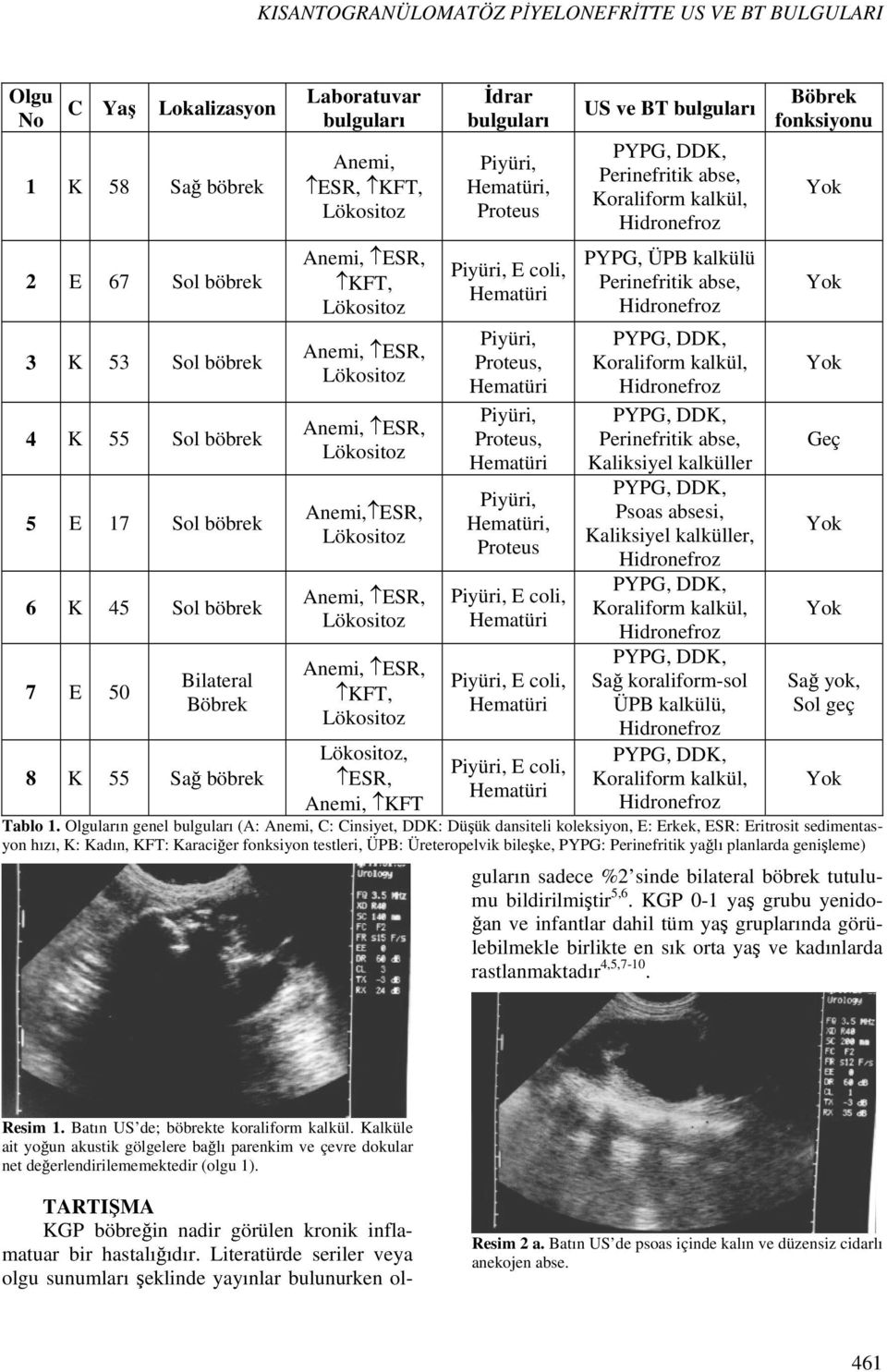 abse, PYPG, ÜPB kalkülü Perinefritik abse, Perinefritik abse, Kaliksiyel kalküller Psoas absesi, Kaliksiyel kalküller, Sağ koraliform-sol ÜPB kalkülü, Böbrek fonksiyonu Geç Sağ yok, Sol geç Tablo 1.