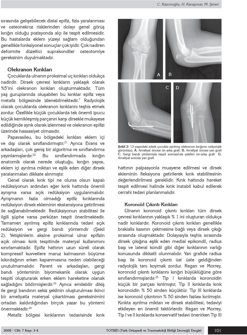 Olekranon Kırıkları Çocuklarda ulnanın proksimal uç kırıkları oldukça nadirdir. Dirsek çevresi kırıkların yaklaşık olarak %5 ini olekranon kırıkları oluşturmaktadır.