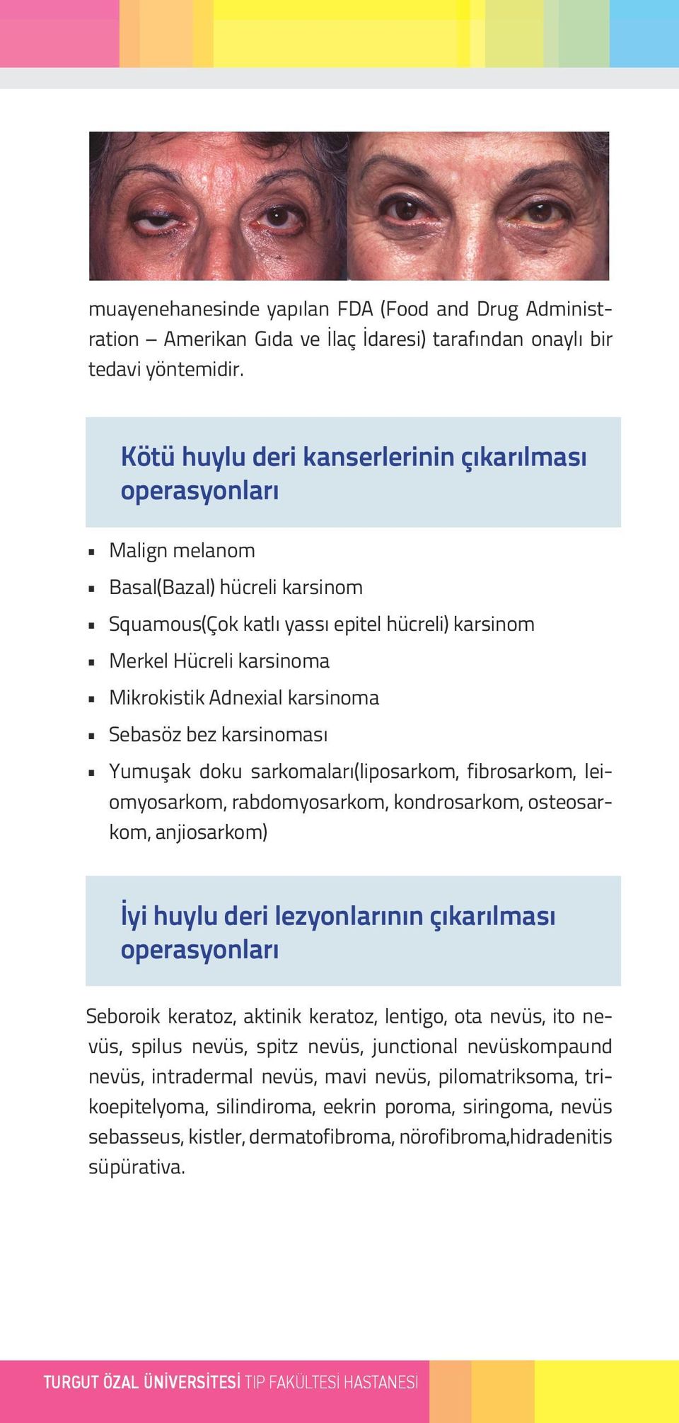 karsinoma Sebasöz bez karsinoması Yumuşak doku sarkomaları(liposarkom, fibrosarkom, leiomyosarkom, rabdomyosarkom, kondrosarkom, osteosarkom, anjiosarkom) İyi huylu deri lezyonlarının çıkarılması