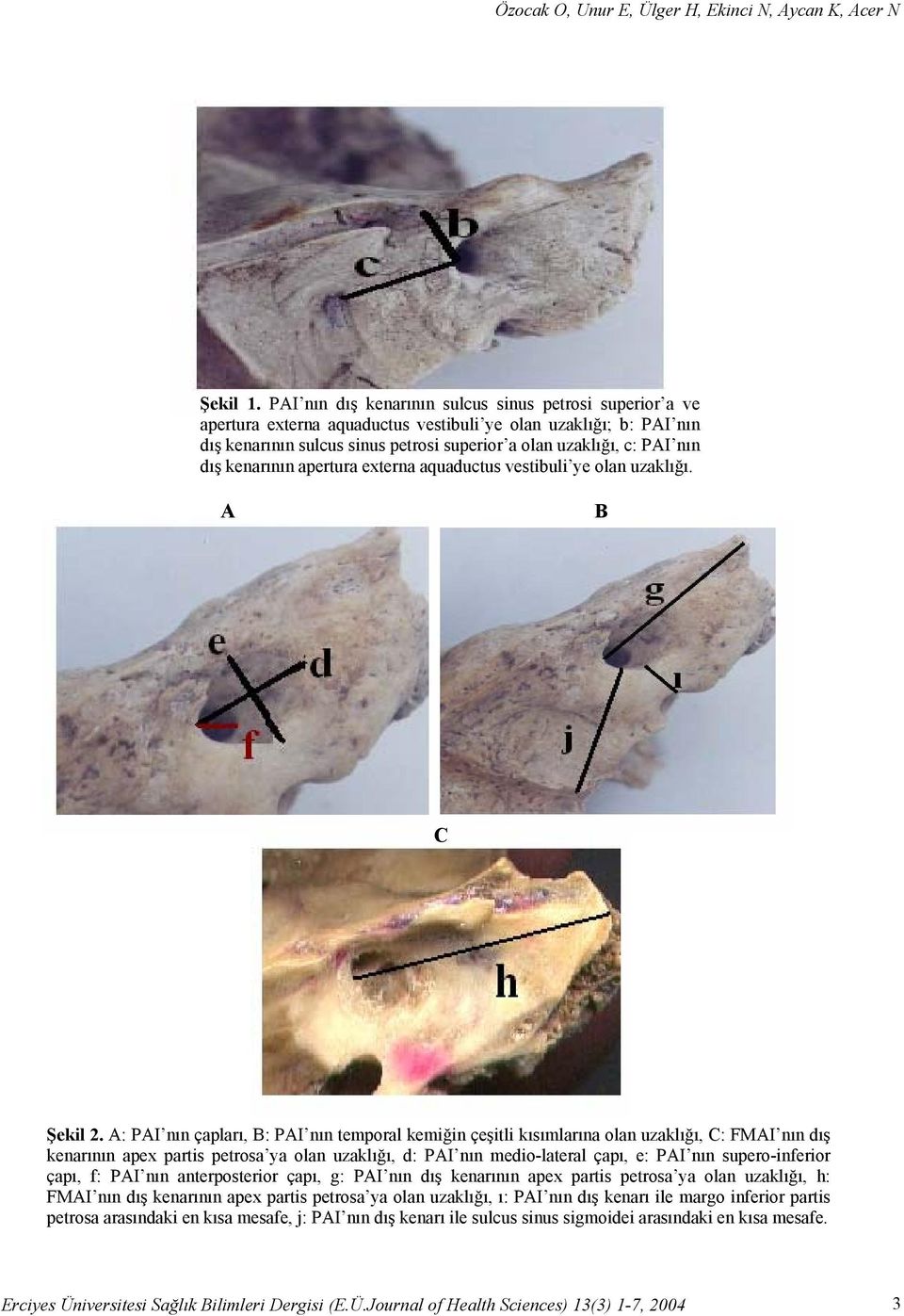 kenarının apertura externa aquaductus vestibuli ye olan uzaklığı. A B C Şekil 2.