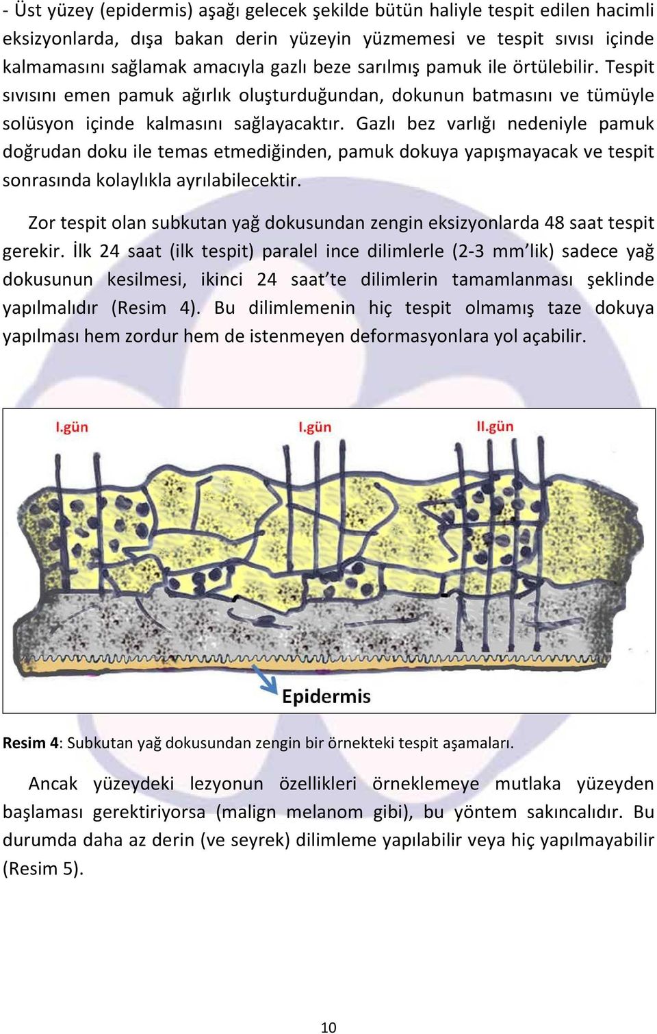 Gazlı bez varlığı nedeniyle pamuk doğrudan doku ile temas etmediğinden, pamuk dokuya yapışmayacak ve tespit sonrasında kolaylıkla ayrılabilecektir.