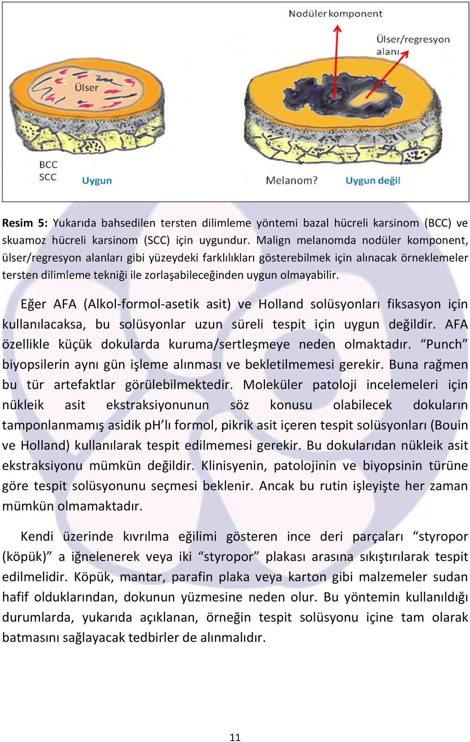 Eğer AFA (Alkol-formol-asetik asit) ve Holland solüsyonları fiksasyon için kullanılacaksa, bu solüsyonlar uzun süreli tespit için uygun değildir.