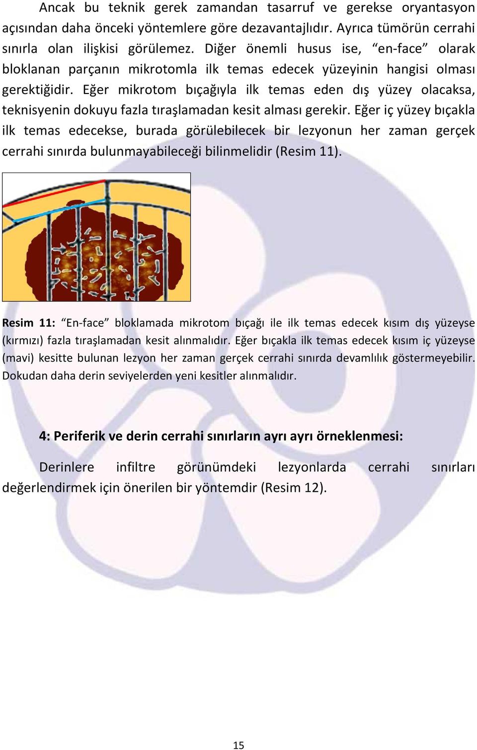 Eğer mikrotom bıçağıyla ilk temas eden dış yüzey olacaksa, teknisyenin dokuyu fazla tıraşlamadan kesit alması gerekir.