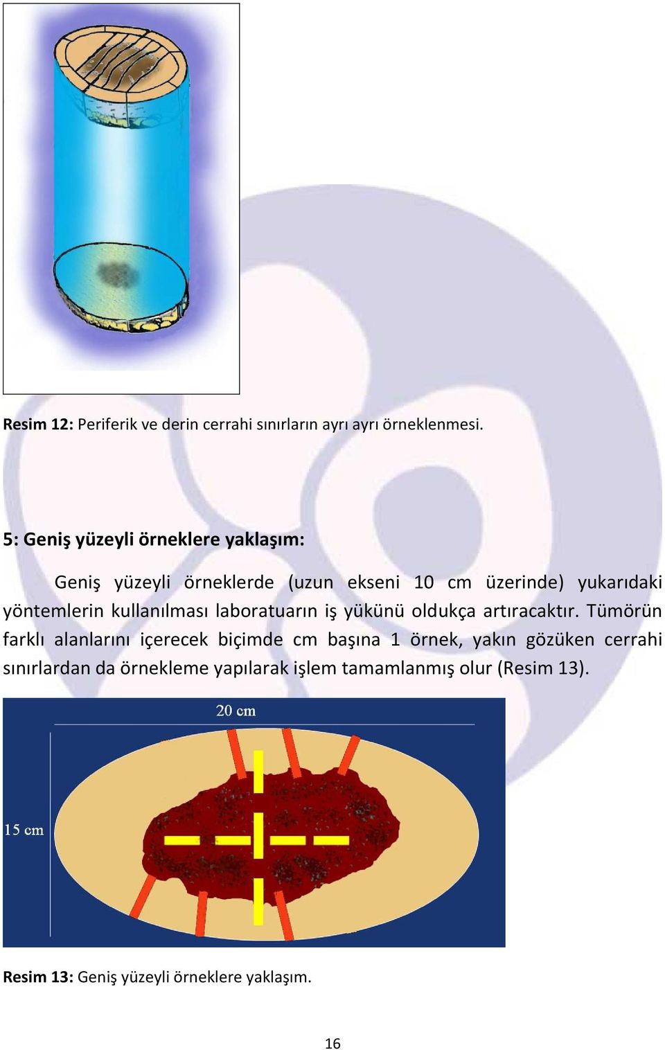 yöntemlerin kullanılması laboratuarın iş yükünü oldukça artıracaktır.