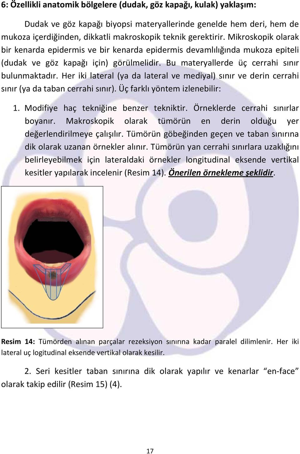 Her iki lateral (ya da lateral ve mediyal) sınır ve derin cerrahi sınır (ya da taban cerrahi sınır). Üç farklı yöntem izlenebilir: 1. Modifiye haç tekniğine benzer tekniktir.