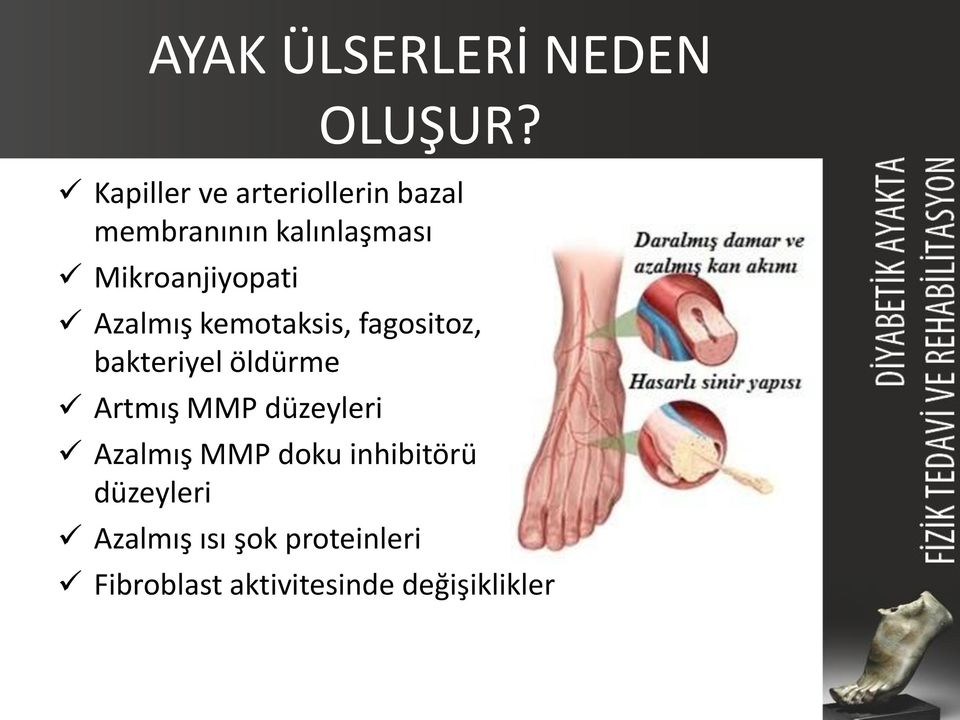 Mikroanjiyopati Azalmış kemotaksis, fagositoz, bakteriyel öldürme