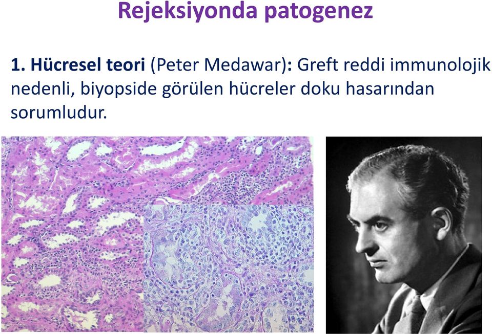 Greft reddi immunolojik nedenli,