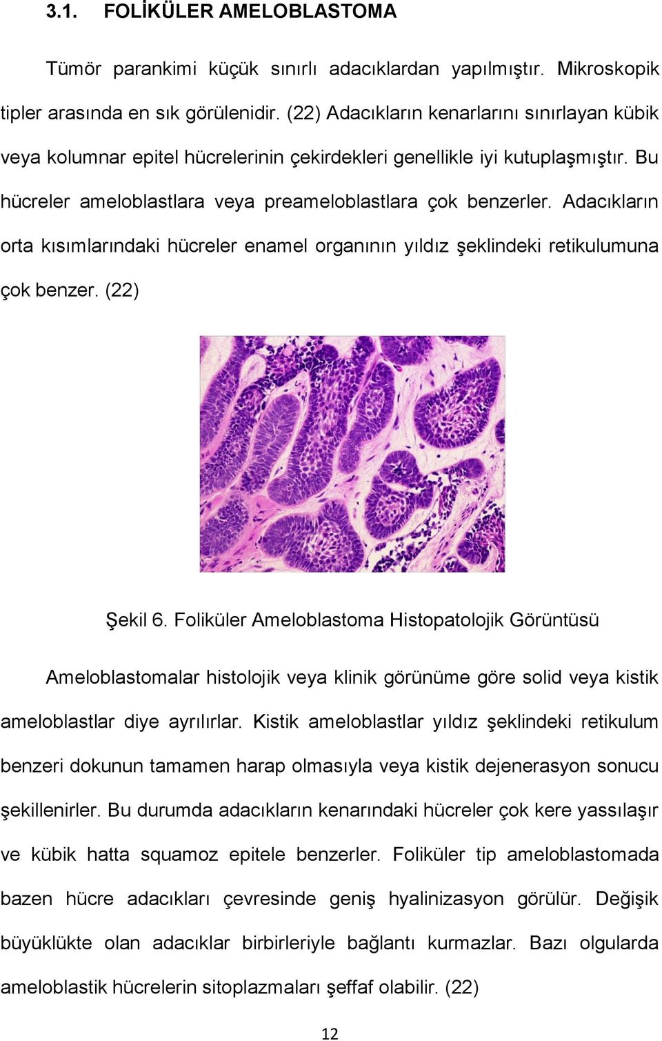 Adacıkların orta kısımlarındaki hücreler enamel organının yıldız şeklindeki retikulumuna çok benzer. (22) Şekil 6.