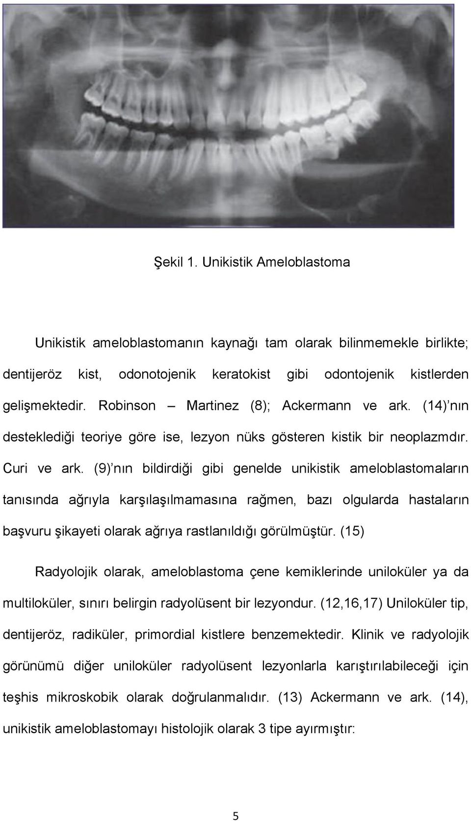 (9) nın bildirdiği gibi genelde unikistik ameloblastomaların tanısında ağrıyla karşılaşılmamasına rağmen, bazı olgularda hastaların başvuru şikayeti olarak ağrıya rastlanıldığı görülmüştür.
