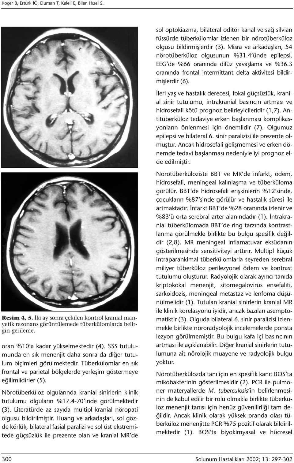 İleri yaş ve hastalık derecesi, fokal güçsüzlük, kranial sinir tutulumu, intrakranial basıncın artması ve hidrosefali kötü prognoz belirleyicileridir (1,7).