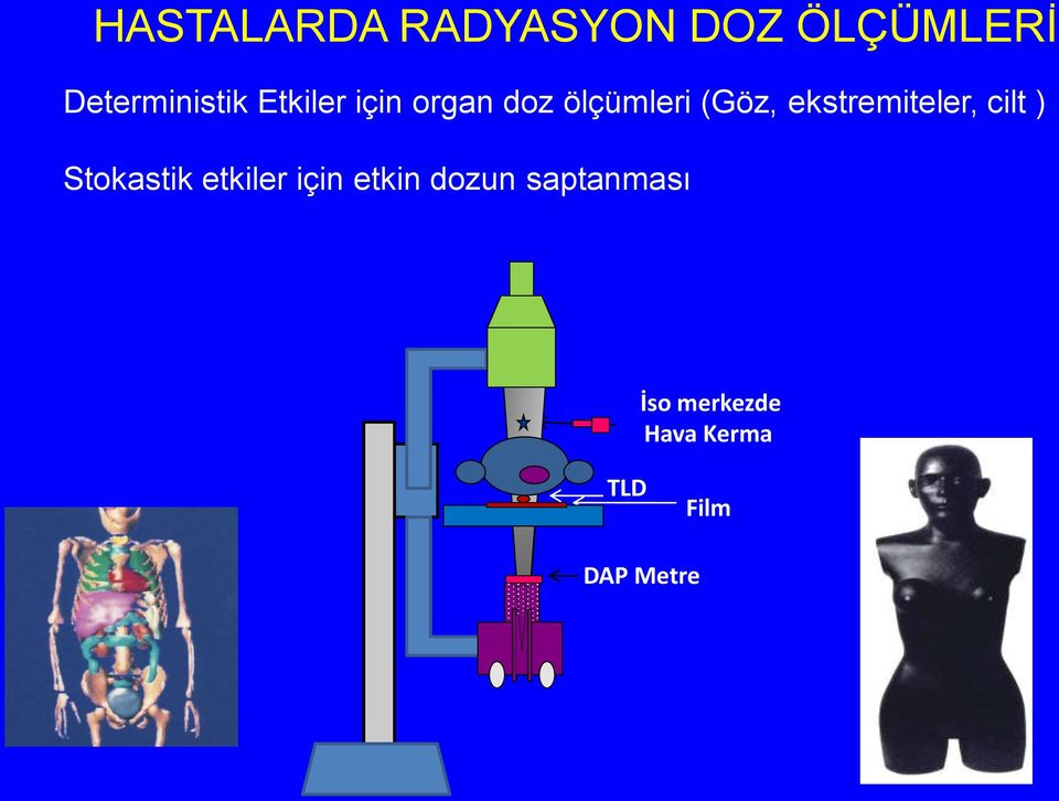 ekstremiteler, cilt ) Stokastik etkiler için