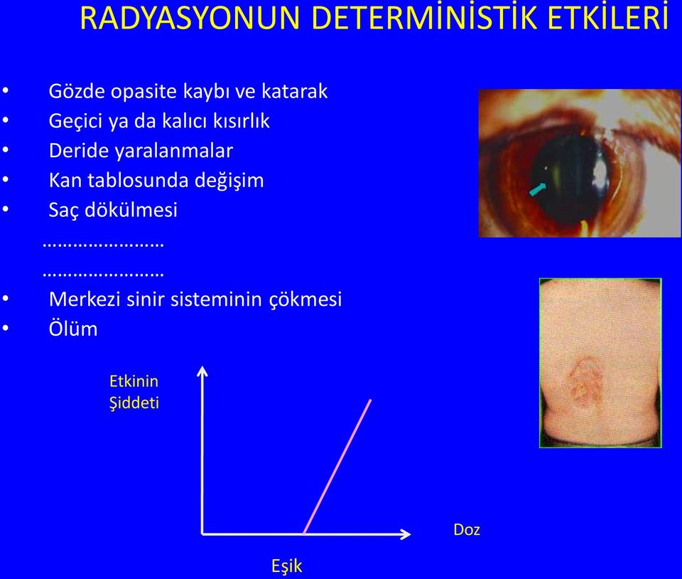 yaralanmalar Kan tablosunda değişim Saç dökülmesi