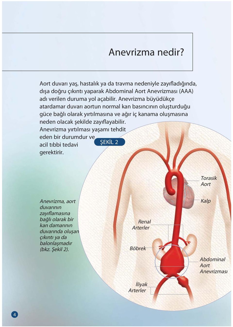 Anevrizma büyüdükçe atardamar duvarı aortun normal kan basıncının oluşturduğu güce bağlı olarak yırtılmasına ve ağır iç kanama oluşmasına neden olacak şekilde