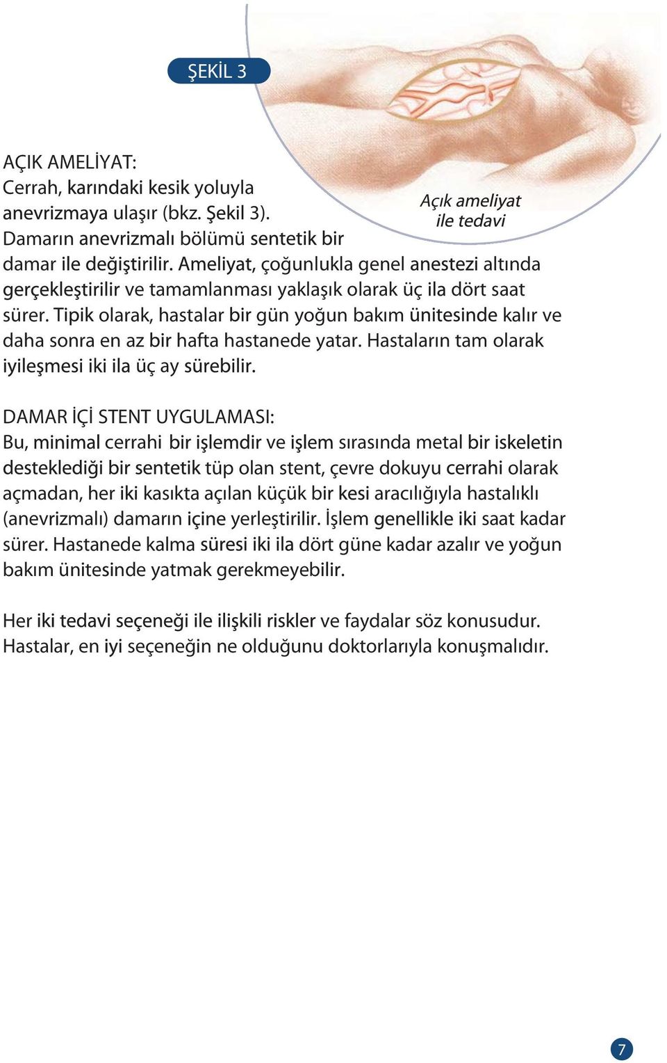 Hastaların tam olarak üç ay DAMAR İÇİ STENT UYGULAMASI: Bu, cerrahi ve sırasında metal n tüp olan stent, çevre dokuyu olarak açmadan, her kasıkta açılan küçük b