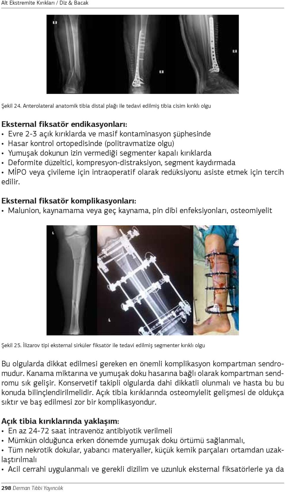 ortopedisinde (politravmatize olgu) Yumuşak dokunun izin vermediği segmenter kapalı kırıklarda Deformite düzeltici, kompresyon-distraksiyon, segment kaydırmada MİPO veya çivileme için intraoperatif