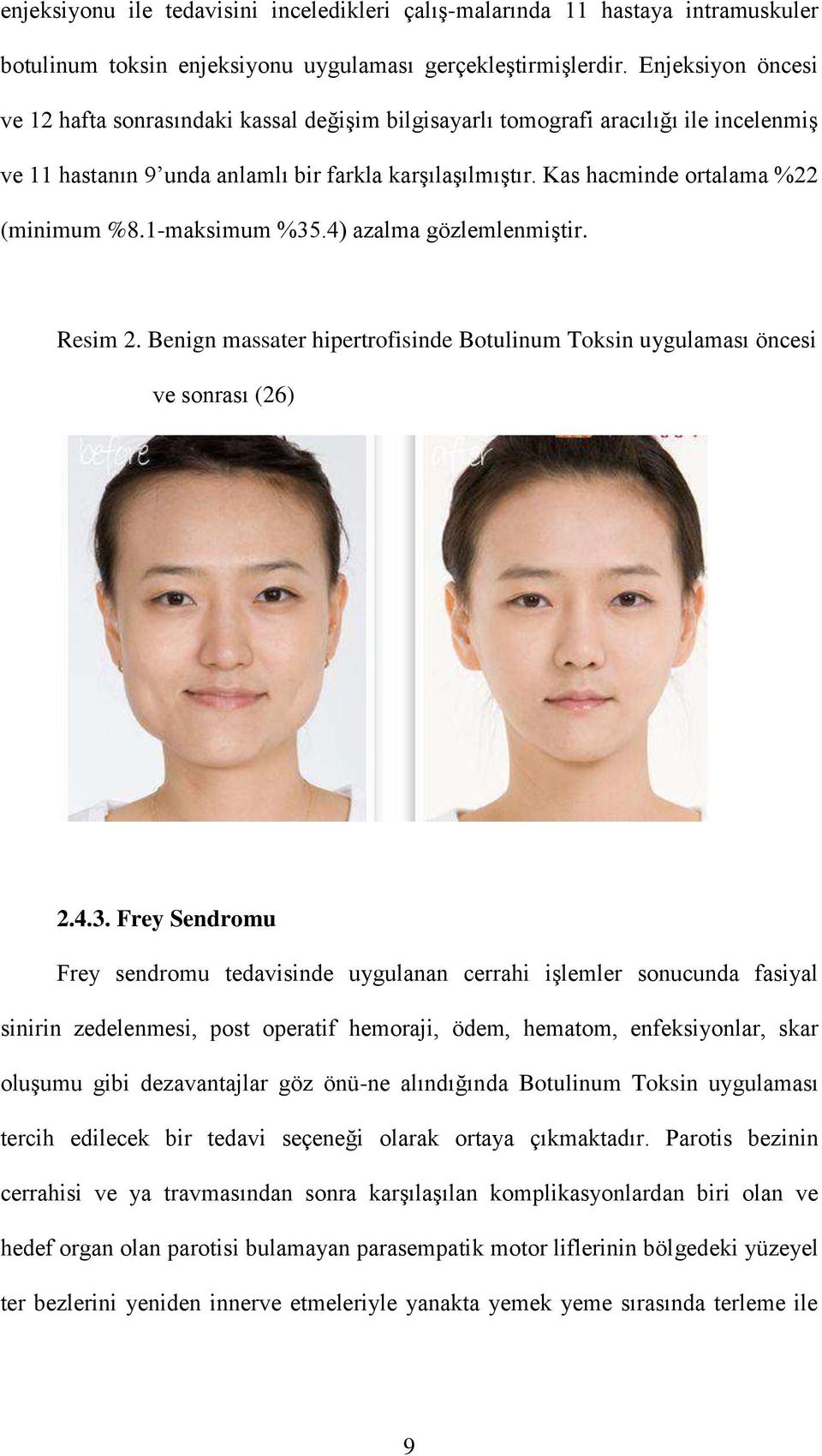 Kas hacminde ortalama %22 (minimum %8.1-maksimum %35