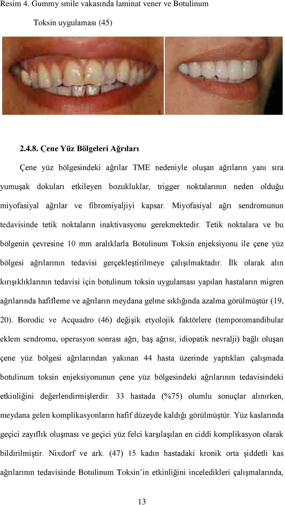 fibromiyaljiyi kapsar. Miyofasiyal ağrı sendromunun tedavisinde tetik noktaların inaktivasyonu gerekmektedir.