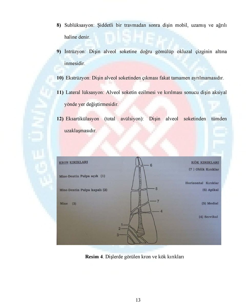 10) Ekstrüzyon: Dişin alveol soketinden çıkması fakat tamamen ayrılmamasıdır.