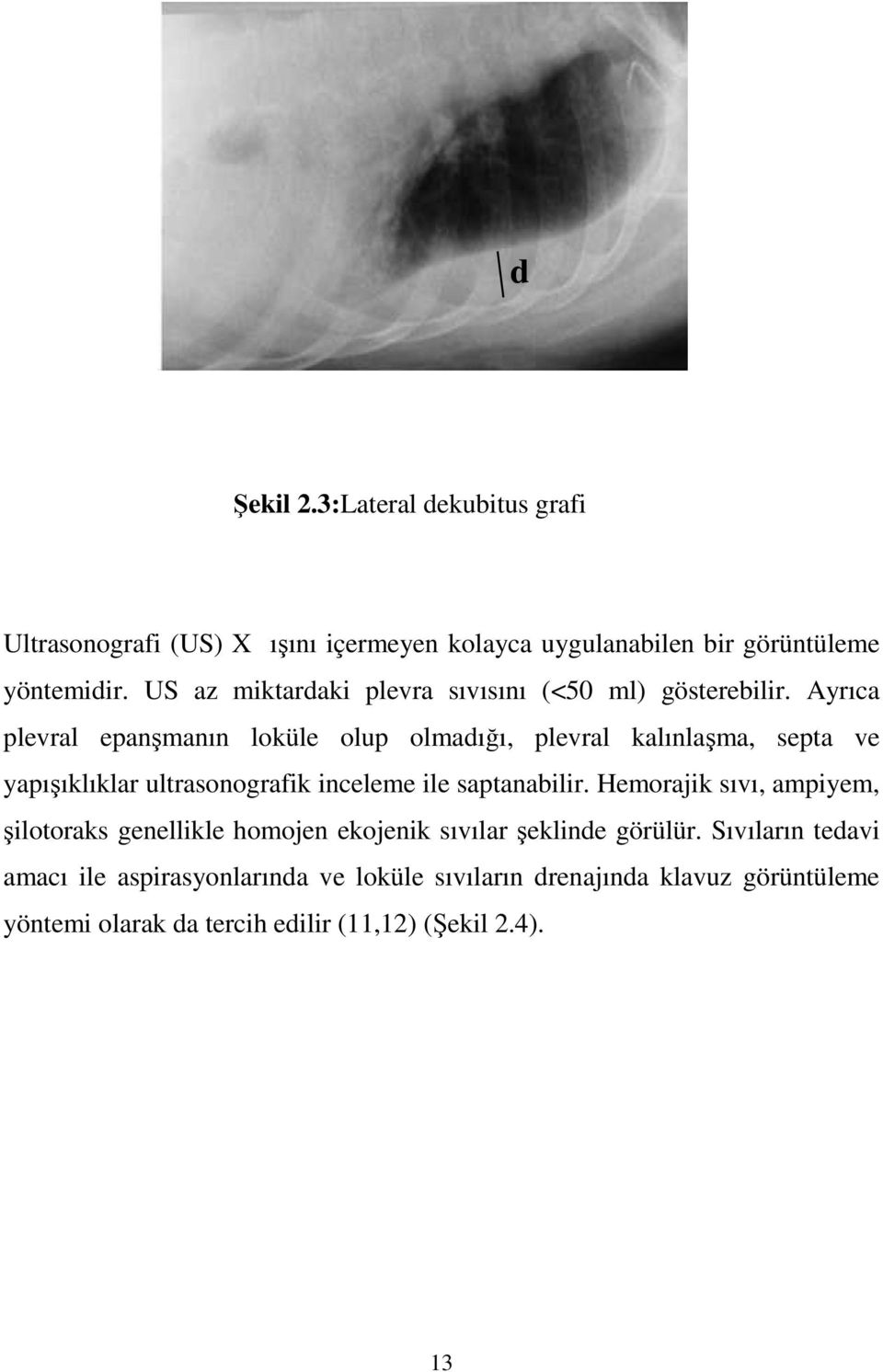 Ayrıca plevral epanşmanın loküle olup olmadığı, plevral kalınlaşma, septa ve yapışıklıklar ultrasonografik inceleme ile saptanabilir.