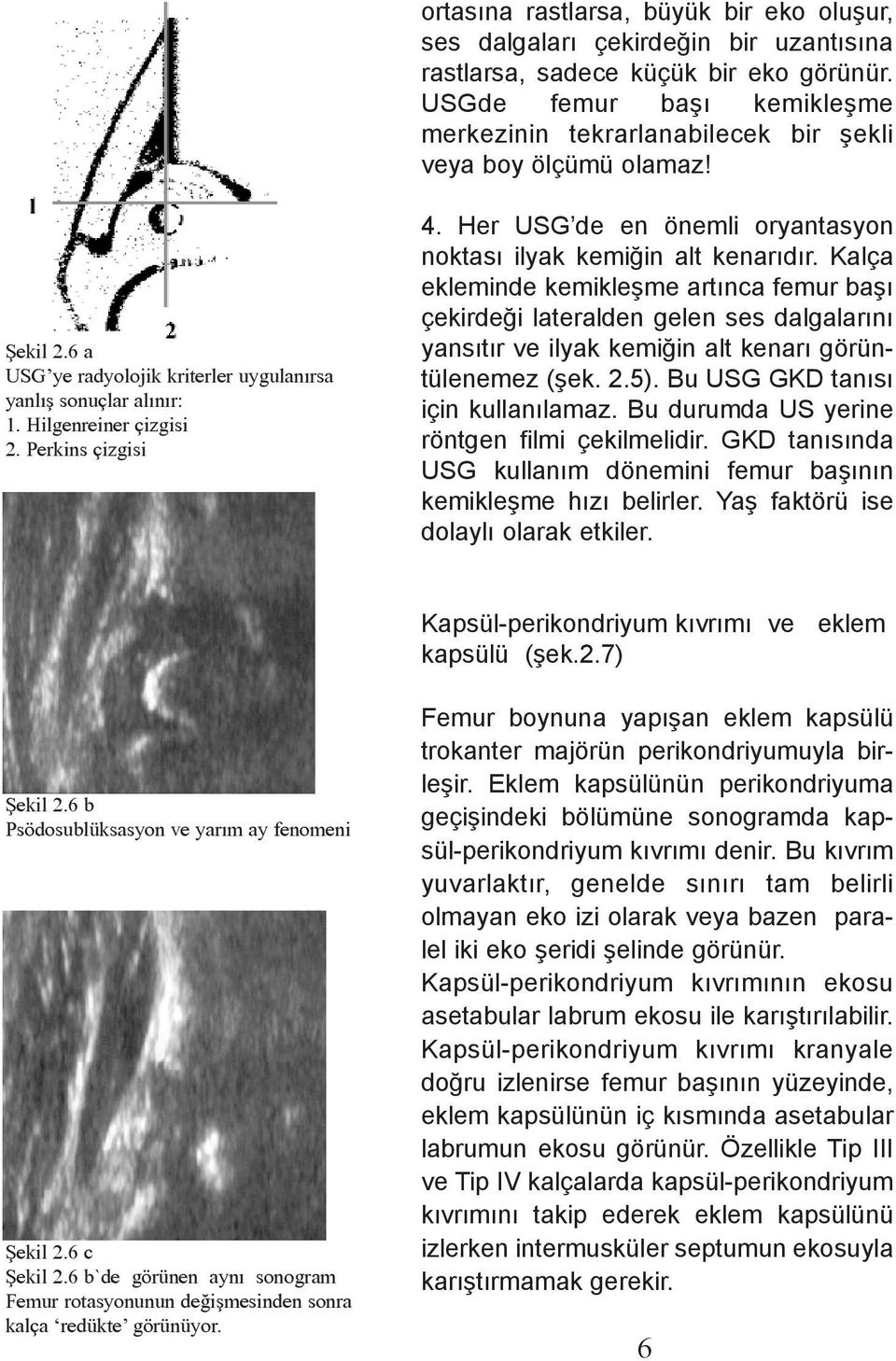 Perkins çizgisi 4. Her USG de en önemli oryantasyon noktasý ilyak kemiðin alt kenarýdýr.