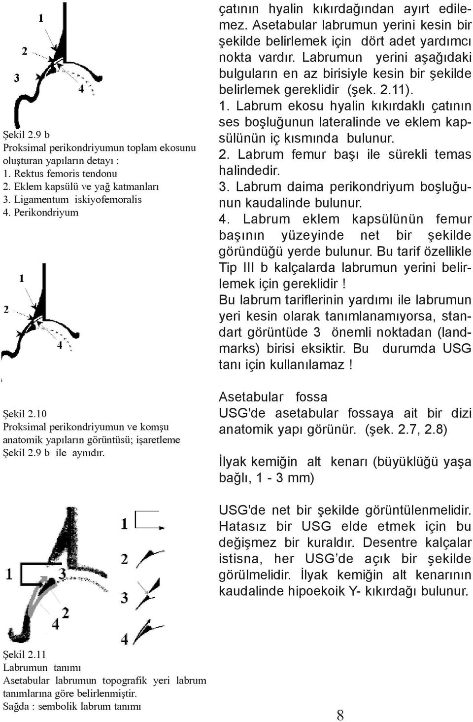 Asetabular labrumun yerini kesin bir þekilde belirlemek için dört adet yardýmcý nokta vardýr. Labrumun yerini aþaðýdaki bulgularýn en az birisiyle kesin bir þekilde belirlemek gereklidir (þek. 2.11).