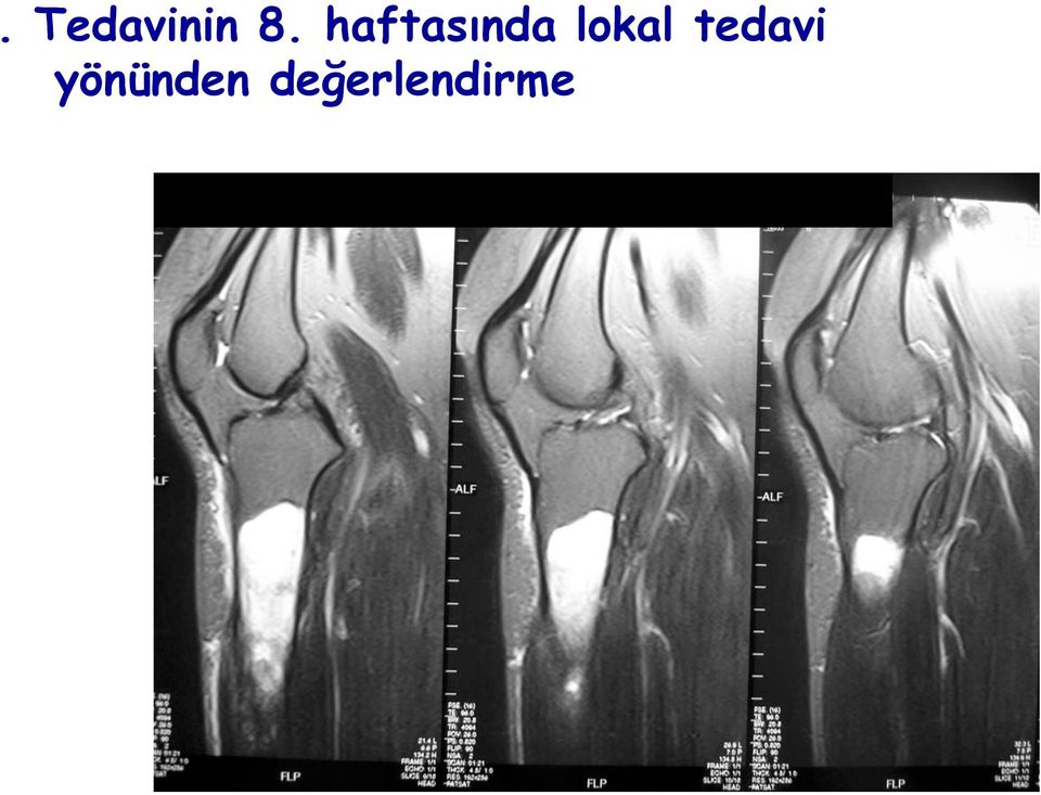 lokal tedavi